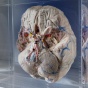 A specimen on display at the Brain Museum. 